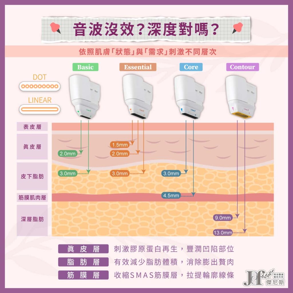 凍結青春臉龐-音波為什麼沒效(音波+填充)_4_0