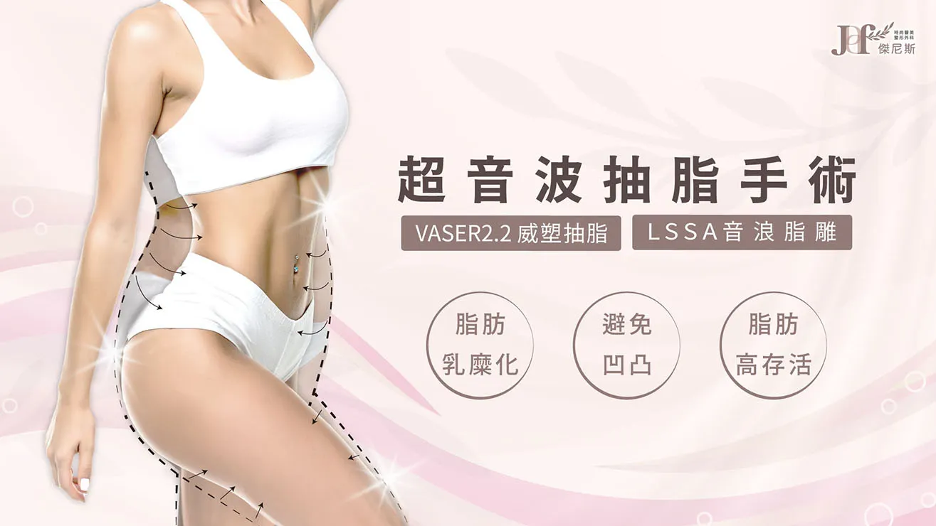 超音波抽脂手術_首頁圖1315x740